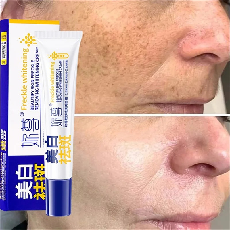 強力なシミ取り美白クリーム 肌を素早く明るくする メラニン色 - Charcoal Whitening Paste のレビューと価格