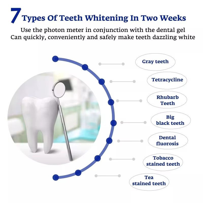 インテリジェントLEDブルーライトポータブルUSB/iPho - Teeth Whitening Gum のレビューと価格