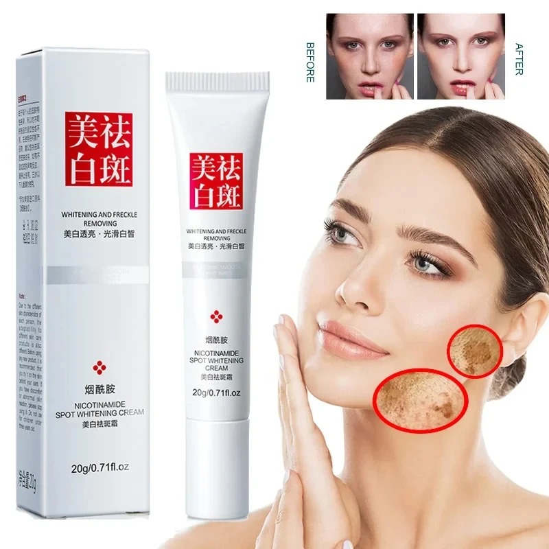 そばかすの色褪せと改善 ブラックスポット フェイスクリーム  - Charcoal Whitening Paste のレビューと価格