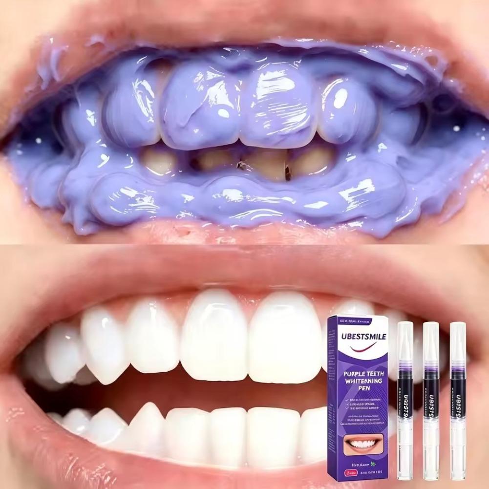 パープル歯のホワイトニングペンV34、PAPカラーコレクター - Teeth Whitening Gel Pen のレビューと価格