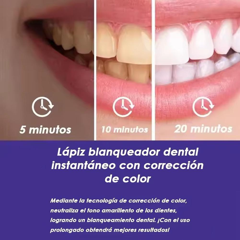 パープル歯のホワイトニングペンV34、PAPカラーコレクター - Teeth Whitening Gel Pen のレビューと価格