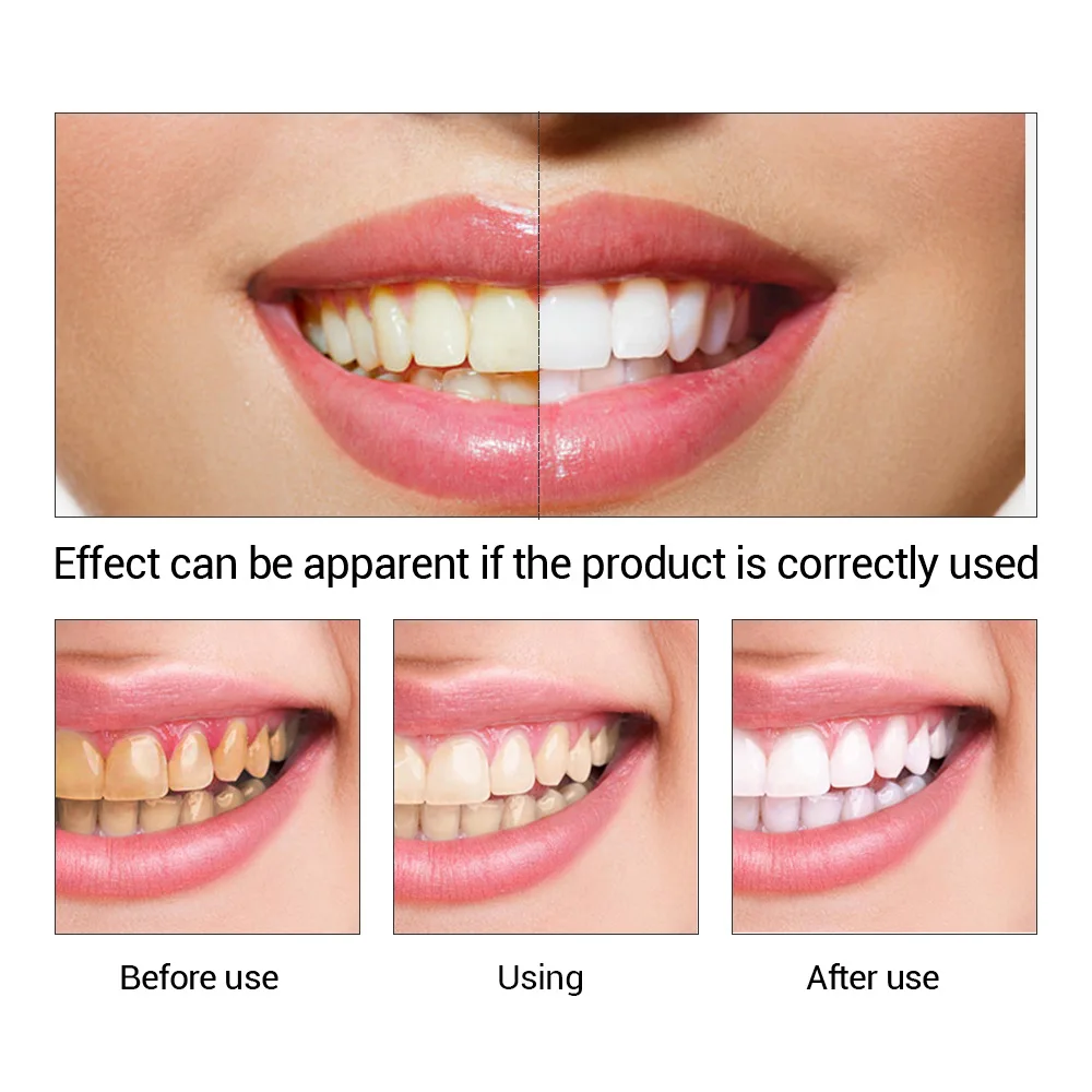 歯のホワイトニングエッセンス,口腔衛生,歯のホワイトニング, - Teeth Whitening Powder のレビューと価格