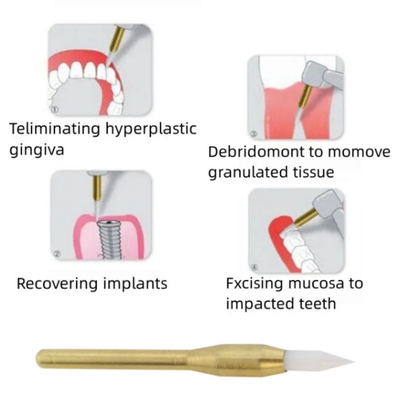 歯科用ソフトトリマーバー外科用歯肉退縮過形成性歯肉切削歯科歯 - Teeth Whitening Gum のレビューと価格