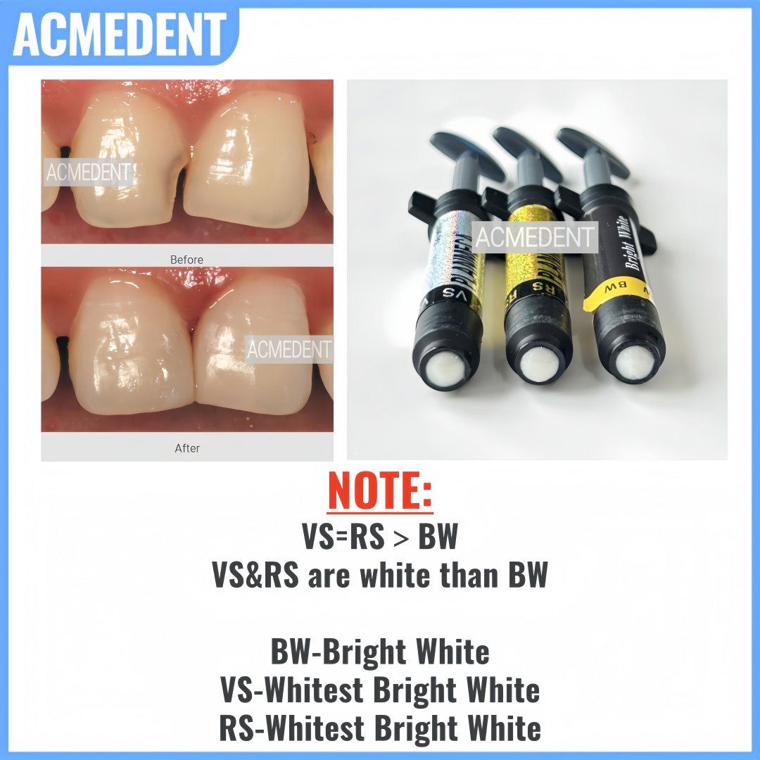 4.5 グラム歯科複合樹脂ベニア光硬化明るい白ハイブリッド審 - Teeth Whitening Vs Veneers のレビューと価格